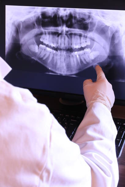 Best Emergency Dentist for Lost Fillings or Crowns in North Falmouth, MA