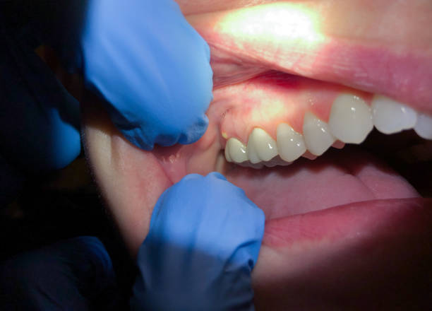 Best Holiday Emergency Dentist in North Falmouth, MA