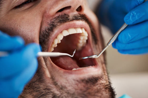 Best Broken or Cracked Tooth Emergency Dentist in North Falmouth, MA