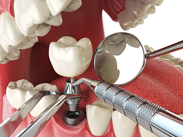 Best Emergency Dental Services for Seniors in North Falmouth, MA